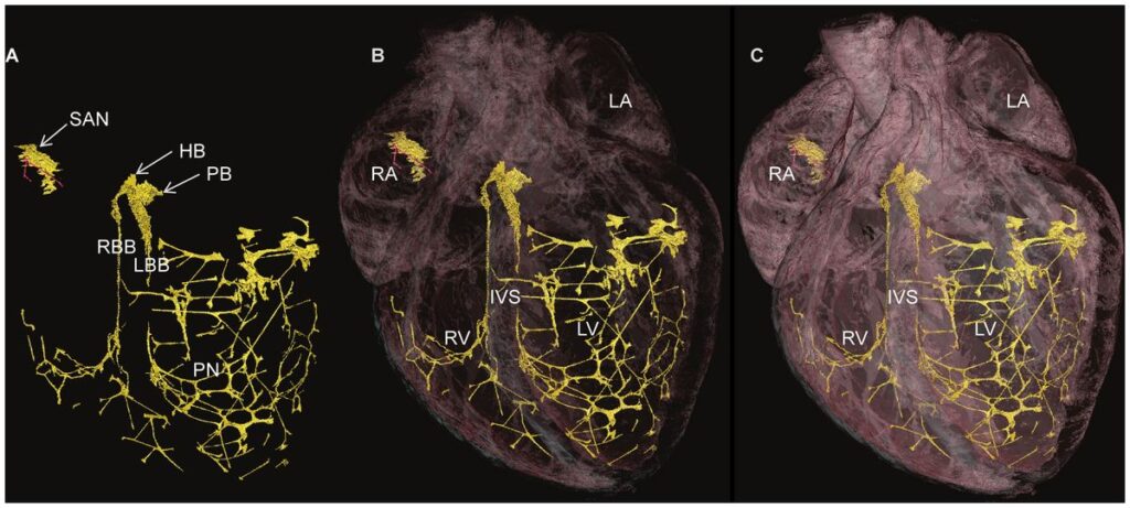 Grafika 3D układu bodźcotwórczo-przewodzącego serca
