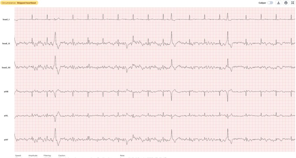TeltoHeart od Teltonika Telemedic – zaawansowana opaska do monitorowania pracy serca - TeltoHeart