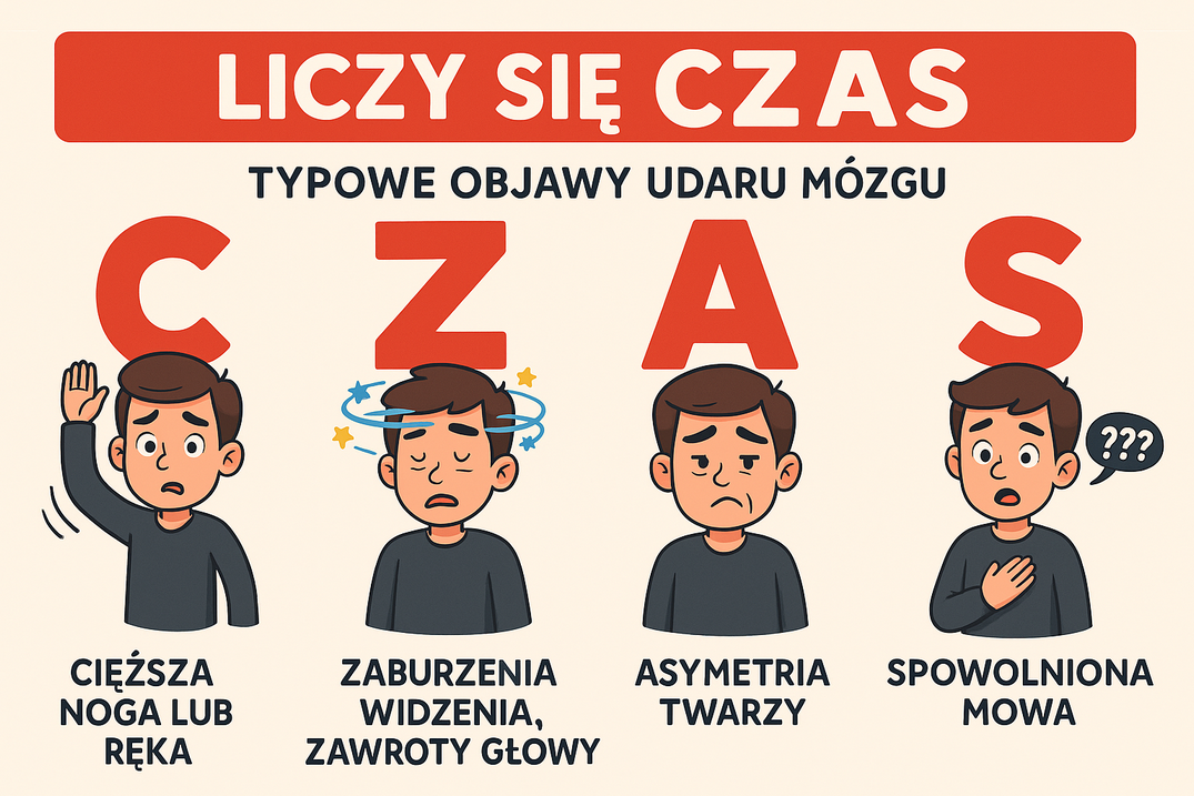 Udar mózgu