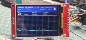 mobilne ekg